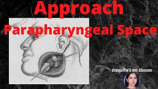 172Approaches to parapharyngeal space surgicalapproach parapharyngeal space surgeryeducation [upl. by Ilyse277]