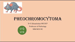 Pheochromocytoma Endocrine Pathology University questions MBBS [upl. by Peppard]