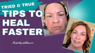 How to heal faster from laser resurfacing deep peels ablative face treatments [upl. by Esme942]