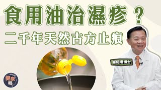 轉季濕疹患者必看！  改善濕疹 就靠一種食用油？｜中醫5大濕疹止痕法 重症濕疹患者當寶｜二千年前天然古方 嬰兒都用！｜健康嗎HealthCodeHK【問問崔博士】濕疹篇上集eczema [upl. by Dorca]