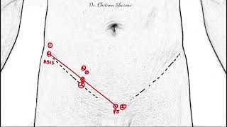 Surface marking of inguinal canal and its clinical correlations [upl. by Baras52]