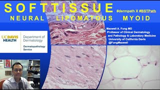 DERMATOPATHOLOGY Soft Tissue Tumors Neural Lipomatous Myoid [upl. by Carlton606]