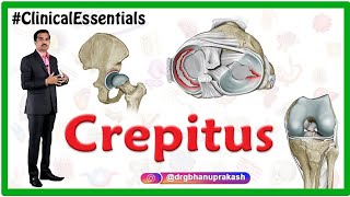 Crepitus of the Joints  Clinical essentials [upl. by Southworth]