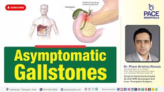 Asymptomatic or SymptomLess Gallstones  All you need to Know [upl. by Nassi]