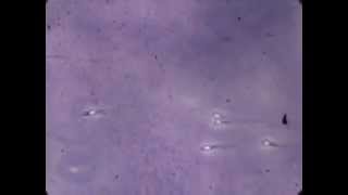 Fascinating lab footage of sperm [upl. by Sillig]