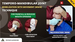 TMJ MOBILIZATION WITH MOVEMENT TECHNIQUE FOR TREATING PAINFUL AND REDUCED MOUTH OPENING [upl. by Anitirhc]