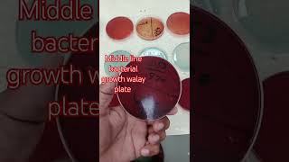 Bacterial growth walay plate onthisday music friend ship bacteriabacterialvaginosis bacterial [upl. by Ahsircal]