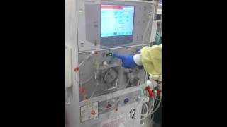 DIALYSIS PART 3 Recirculation [upl. by Atinej368]