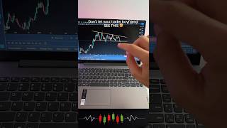 Is This The Perfect Mousepad For Traders 🤯 trading forex mousepad stockmarket [upl. by Nilorac]