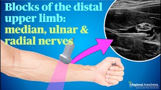 Ultrasound guided blocks of the median ulnar and radial nerves [upl. by Retsek]