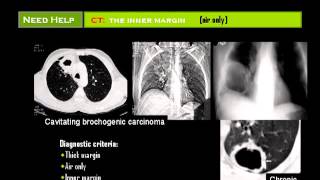 Chest X ray  Dr Mamdouh Mahfouz [upl. by Norbie]