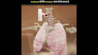 How does Inhaler Work for Asthma [upl. by Faso]