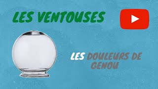 🤕🧘🧘‍♂️ Ventouses  Douleurs de Genou [upl. by Ojyma]