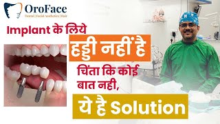 Dental Implant के लिए हड्डी नहीं है  चिंता कि कोई बात नही ये है solution ImplantsDr Aniruddha [upl. by Arbma3]