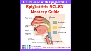 Epiglottitis For NCLEX epiglottitis education nursingexam nclexquestions nclexpreparation eaxm [upl. by Arobed]