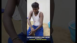 elbow dislocation treatment  முழங்கை மூட்டு விலகல்  vadapalani  puttur kattu [upl. by Wendelina]