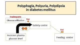 Polyuria Polyphagia Polydipsia in Diabetes mellitus [upl. by Nnairahs]