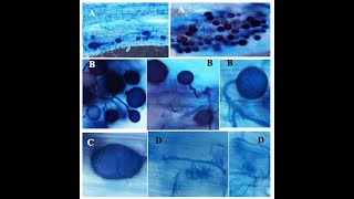 CLEARING AND STAINING OF MYCORRHIZAL ROOTS  PRACTICAL [upl. by Nahtnaoj]