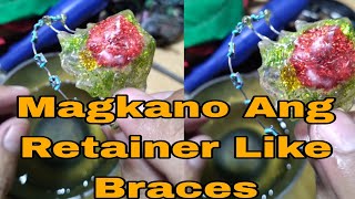 Magkano Ang Retainer Like Braces price Philippines [upl. by Ymrej]