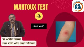 Mantoux Test मंटौक्स टेस्ट or Tuberculin Skin Test I डॉ अंकित पारख बाल टीबी और छाती विशेषज् [upl. by Rehpotsihrc]