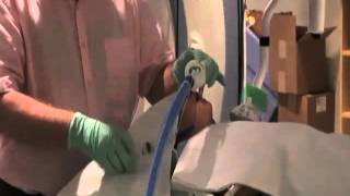 Laryngeal Mask Airway LMA Insertion in Pediatrics [upl. by Bajaj]