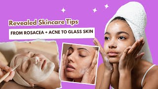 I reviewed ROBINS journey From rosacea  acne to glass skin The science of selfcare [upl. by Halimaj]