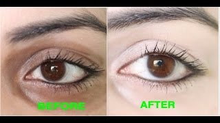 How to Remove Dark Circles Naturally in 3 Days 100 Results [upl. by Carlyle700]