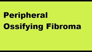 Peripheral Ossifying Fibroma [upl. by Schilit722]