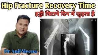 Hip joint recovery time  Hip joint Fracture Recovery Time  Hip joint Fracture Exercise  in Hindi [upl. by Akinat]