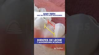 Cuida los DIENTES de LECHE  Esto puede pasar si se caen antes de tiempo  Mantenedor de espacio [upl. by Casilde]