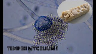 Tempeh mycelium under the microscope fermented soybeans Beautiful and succulent [upl. by Fia]