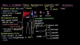 What is chronic myelogenous leukemia [upl. by Aratahs251]