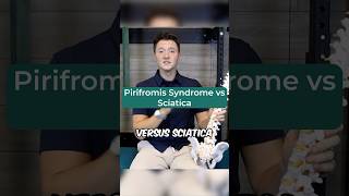 Most Common Causes of Piriformis Syndrome piriformissyndrome sciaticnerve [upl. by Aronek]