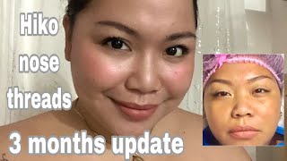 HIKO NON SURGICAL NOSE LIFT 3 months Update  Ga Caballero [upl. by Danell]