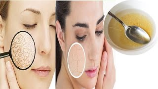 How to Get Rid of Dry Skin in Winters । Dry Skin Care Tips Cracked Skin Home Remedies [upl. by Yehudit]