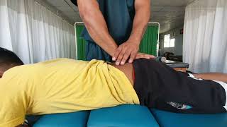 functional scoliosis with PIVD amp anteriorlysthesis and sciatica [upl. by Cheyne]