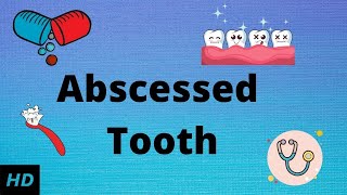 Abscessed tooth Causes SIgns and Symptoms Diagnosis and Treatment [upl. by Elah]