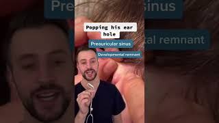 Derm explains preauricular sinus [upl. by Pedrick]