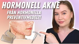 Varför du har Hormonell Akne  Har hormonella preventivmedel någon inverkan [upl. by Gibeon424]