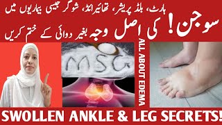 Foot And Ankle Swelling What Causes It  Edema Causes amp Treatment Listen Your Body [upl. by Imorej619]