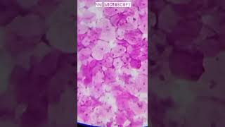 Squamous epithelial cells microscope slide🔬shortvideo youtube [upl. by Meadows]