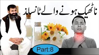 Tonsils  Causes amp treatment of Tonsils Infection  Homeopathic DRMMUNAWAR DAWOOD [upl. by Morra572]