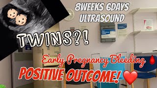 Bleeding In Early Pregnancy Positive Outcome 86 weeks ultrasound IS IT TWINS 🤭 [upl. by Dorwin710]