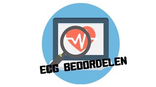 ECG beoordelen  Hoe begin ik [upl. by Adnor682]