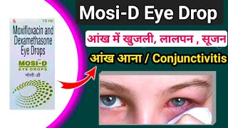 MosiD Eye Drops  Mosi D Eye drops use in Hindi  Pink Eyes  Conjunctivitis  आंख आना  Drops [upl. by Assili108]