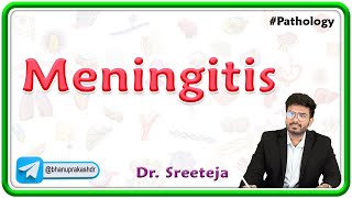 4 Meningitis  USMLE Step 1 Pathology [upl. by Oidacra]