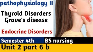 Disorders of the Thyroid Gland  hyperthyroidism Graves disease in English Urdu [upl. by Weber48]