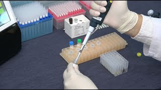 NuActor and ExAmplar HBV  Test Procedure [upl. by Nunciata658]