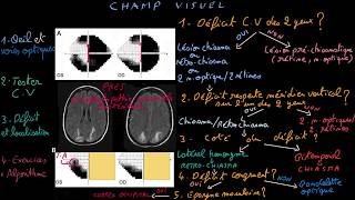 Champ visuel  Docteur Synapse [upl. by Eelibuj]