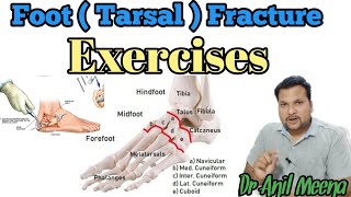 metatarsal bone fracture recovery exercises  metatarsal fracture exercises  metatarsal  in hindi [upl. by Hulton]